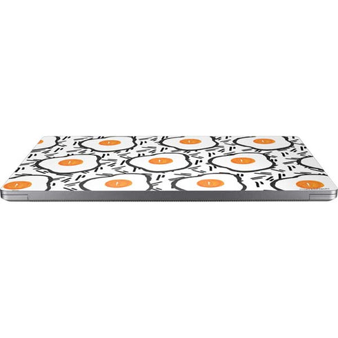 Bouffants and Broken Hearts Eggs Universal Laptop 12in (9.8 x 6.8in) Skin